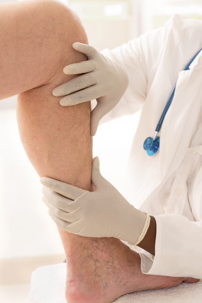 L’insuffisance veineuse ou maladie veineuse La maladie veineuse ou insuffisance veineuse est un problème majeur de santé publique à travers le monde et regroupe les varices, la phlébite et l'embolie pulmonaire.